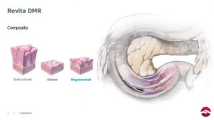 WVU Medicine leads trial of procedure to maintain weight loss without GLP-1 drugs